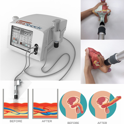 Macchina pneumatica di terapia di Shockwave di 12 teste per distorsione della caviglia